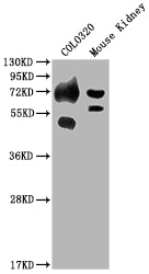 Western Blot Positive WB detected in: COLO320 whole cell lysate, Mouse Kidney tissue All lanes: SLC39A4 antibody at 1:2000 Secondary Goat polyclonal to rabbit IgG at 1/50000 dilution Predicted band size: 69, 67 kDa Observed band size: 69 kDa