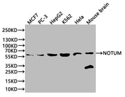 Western Blot Positive WB detected in: MCF7 whole cell lysate(20µg), PC-3 whole cell lysate(20µg), HepG2 whole cell lysate(20µg), K562 whole cell lysate(20µg), Hela whole cell lysate(20µg), Mouse Brain tissue lysate(20µg) All lanes: NOTUM antibody...