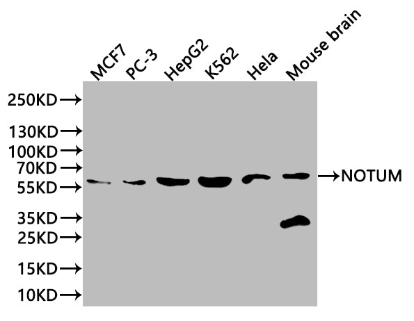 Western Blot Positive WB detected in: MCF7 whole cell lysate(20µg), PC-3 whole cell lysate(20µg), HepG2 whole cell lysate(20µg), K562 whole cell lysate(20µg), Hela whole cell lysate(20µg), Mouse Brain tissue lysate(20µg) All lanes: NOTUM antibody...