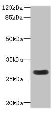 Western blot All lanes: MORN3 antibody at 2µg/ml + Mouse kidney tissue Secondary Goat polyclonal to rabbit IgG at 1/10000 dilution Predicted band size: 28, 19 kDa Observed band size: 28 kDa