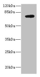 Western blot All lanes: DARS2 antibody at 10ug/ml + MCF-7 whole cell lysate Secondary Goat polyclonal to rabbit IgG at 1/10000 dilution Predicted band size: 74 kDa Observed band size: 74 kDa