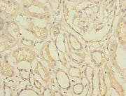 Immunohistochemistry of paraffin-embedded human kidney tissue using CSB-PA747492LA01HU at dilution of 1:100