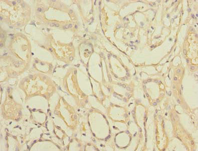 Immunohistochemistry of paraffin-embedded human kidney tissue using CSB-PA747492LA01HU at dilution of 1:100