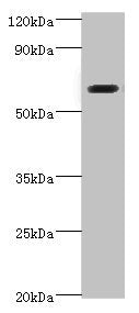 Western blot All lanes: SHC4 antibody at 6ug/ml + Jurkat whole cell lysate Secondary Goat polyclonal to rabbit IgG at 1/10000 dilution Predicted band size: 69, 43 kDa Observed band size: 69 kDa