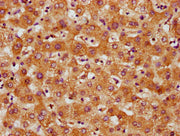 IHC image of CSB-PA747623LA01HU diluted at 1:500 and staining in paraffin-embedded human liver tissue performed on a Leica BondTM system. After dewaxing and hydration, antigen retrieval was mediated by high pressure in a citrate buffer (pH 6.0). S...