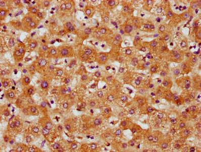 IHC image of CSB-PA747623LA01HU diluted at 1:500 and staining in paraffin-embedded human liver tissue performed on a Leica BondTM system. After dewaxing and hydration, antigen retrieval was mediated by high pressure in a citrate buffer (pH 6.0). S...