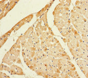 Immunohistochemistry of paraffin-embedded human heart tissue using CSB-PA747630LA01HU at dilution of 1:100