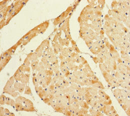 Immunohistochemistry of paraffin-embedded human heart tissue using CSB-PA747630LA01HU at dilution of 1:100