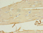 Immunohistochemistry of paraffin-embedded human skeletal muscle tissue using CSB-PA747638LA01HU at dilution of 1:100