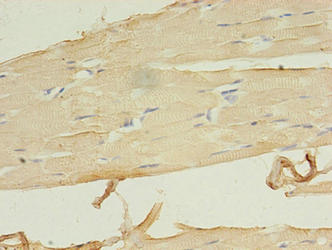 Immunohistochemistry of paraffin-embedded human skeletal muscle tissue using CSB-PA747638LA01HU at dilution of 1:100