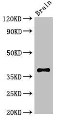Western Blot Positive WB detected in: Mouse brain tissue All lanes: CASP12 antibody at 2.7ug/ml Secondary Goat polyclonal to rabbit IgG at 1/50000 dilution Predicted band size: 39, 20, 30 kDa Observed band size: 39 kDa