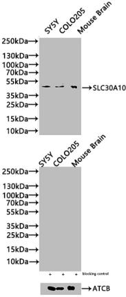 Western Blot Positive WB detected in: SY5Y whole cell lysate(20µg), COLO205 whole cell lysate(20µg), Mouse Brain tissue lysate(20µg) All lanes: SLC30A10 antibody at 1:1000 Secondary Goat polyclonal to rabbit IgG at 1/20000 dilution Predicted band...