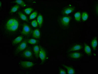 Immunofluorescence staining of A549 cells with CSB-PA747806LA01HU at 1:100, counter-stained with DAPI. The cells were fixed in 4% formaldehyde, permeabilized using 0.2% Triton X-100 and blocked in 10% normal Goat Serum. The cells were then incubat...