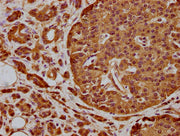 IHC image of CSB-PA747816LA01HU diluted at 1:300 and staining in paraffin-embedded human colon cancer performed on a Leica BondTM system. After dewaxing and hydration, antigen retrieval was mediated by high pressure in a citrate buffer (pH 6.0). S...