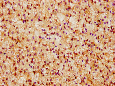 IHC image of CSB-PA747834LA01HU diluted at 1:300 and staining in paraffin-embedded human adrenal gland tissue performed on a Leica BondTM system. After dewaxing and hydration, antigen retrieval was mediated by high pressure in a citrate buffer (pH...