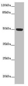 Western blot All lanes: HTR3D antibody at 2µg/ml + Hela whole cell lysate Secondary Goat polyclonal to rabbit IgG at 1/10000 dilution Predicted band size: 51, 31, 26, 46 kDa Observed band size: 51 kDa