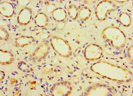 Immunohistochemistry of paraffin-embedded human kidney tissue using CSB-PA748726ESR2HU at dilution of 1:100