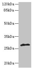 Western blot All lanes: fabI antibody at 5µg/ml + Mouse heart tissue Secondary Goat polyclonal to rabbit IgG at 1/10000 dilution Predicted band size: 28 kDa Observed band size: 28 kDa