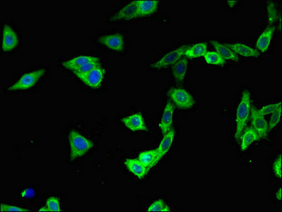 Immunofluorescent analysis of HepG2 cells using CSB-PA750339LA01HU at dilution of 1:100 and Alexa Fluor 488-congugated AffiniPure Goat Anti-Rabbit IgG(H+L)