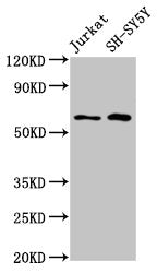 Western Blot Positive WB detected in: Jurkat whole cell lysate, SH-SY5Y whole cell lysate All lanes: BORA antibody at 4.8µg/ml Secondary Goat polyclonal to rabbit IgG at 1/50000 dilution Predicted band size: 62, 54 kDa Observed band size: 62 kDa