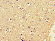 Immunohistochemistry of paraffin-embedded human brain tissue using CSB-PA750882LA01HU at dilution of 1:100