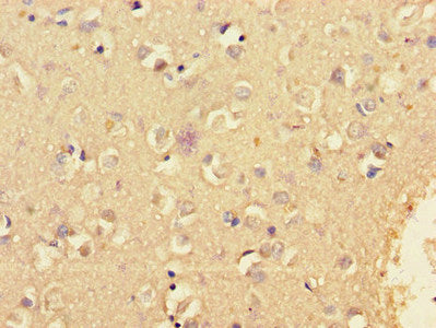 Immunohistochemistry of paraffin-embedded human brain tissue using CSB-PA750882LA01HU at dilution of 1:100