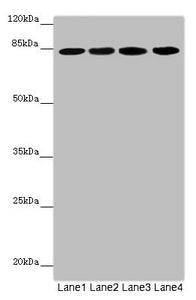 Western blot All lanes: LRSAM1 antibody at 2.57µg/ml Lane 1: Mouse brain tissue Lane 2: Jurkat whole cell lysate Lane 3: Hela whole cell lysate Lane 4: 293T whole cell lysate Secondary Goat polyclonal to rabbit IgG at 1/10000 dilution Predicted ba...