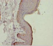 Immunohistochemistry of paraffin-embedded human skin tissue using CSB-PA751010ESR2HU at dilution of 1:100