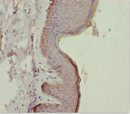 Immunohistochemistry of paraffin-embedded human skin tissue using CSB-PA751010ESR2HU at dilution of 1:100