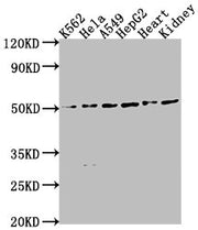 Western Blot Positive WB detected in: K562 whole cell lysate, HeLa whole cell lysate, A549 whole cell lysate, HepG2 whole cell lysate, Mouse heart tissue, Mouse kidney tissue All lanes: ENPP7 antibody at 1:2000 Secondary Goat polyclonal to rabbit...