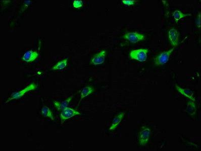 Immunofluorescence staining of U251 cells with CSB-PA751017LA01HU at 1:100, counter-stained with DAPI. The cells were fixed in 4% formaldehyde, permeabilized using 0.2% Triton X-100 and blocked in 10% normal Goat Serum. The cells were then incubat...