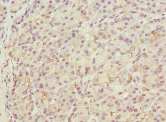 Immunohistochemistry of paraffin-embedded human pancreatic tissue using CSB-PA751092ESR1HU at dilution of 1:100