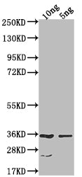 Western Blot Positive WB detected in Recombinant protein All lanes: CESA6 antibody at 1:1000 Secondary Goat polyclonal to rabbit IgG at 1/50000 dilution Predicted band size: 32.6 kDa Observed band size: 34 kDa