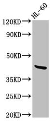 Western Blot Positive WB detected in: HL60 whole cell lysate All lanes: CERS6 antibody at 2.7ug/ml Secondary Goat polyclonal to rabbit IgG at 1/50000 dilution Predicted band size: 45, 46 kDa Observed band size: 45 kDa