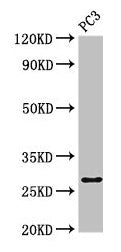 Western Blot Positive WB detected in: PC-3 whole cell lysate All lanes: IL34 antibody at 4µg/ml Secondary Goat polyclonal to rabbit IgG at 1/50000 dilution Predicted band size: 28 kDa Observed band size: 28 kDa