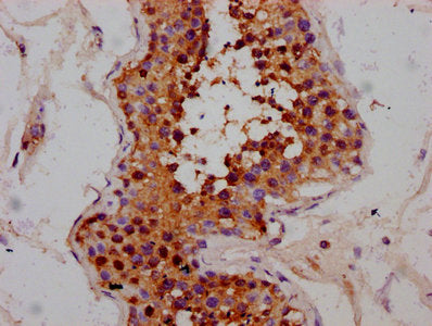 IHC image of CSB-PA751152LA01HU diluted at 1:300 and staining in paraffin-embedded human testis tissue performed on a Leica BondTM system. After dewaxing and hydration, antigen retrieval was mediated by high pressure in a citrate buffer (pH 6.0)....