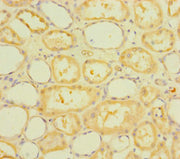 Immunohistochemistry of paraffin-embedded human kidney tissue using CSB-PA751157LA01HU at dilution of 1:100