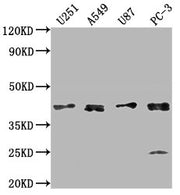 Western Blot Positive WB detected in: U251 whole cell lysate, A549 whole cell lysate, U87 whole cell lysate, PC-3 whole cell lysate All lanes: IKBIP antibody at 1:1000 Secondary Goat polyclonal to rabbit IgG at 1/50000 dilution Predicted band size...