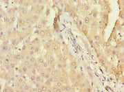 Immunohistochemistry of paraffin-embedded human liver tissue using CSB-PA752098LA01HU at dilution of 1:100