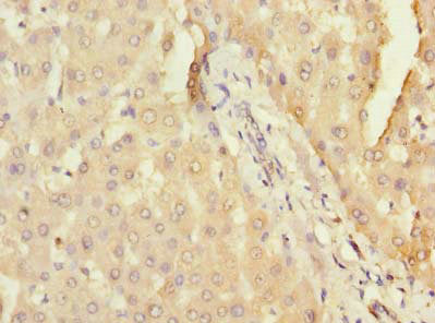 Immunohistochemistry of paraffin-embedded human liver tissue using CSB-PA752098LA01HU at dilution of 1:100