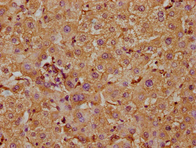 IHC image of CSB-PA752101LA01HU diluted at 1:300 and staining in paraffin-embedded human liver tissue performed on a Leica BondTM system. After dewaxing and hydration, antigen retrieval was mediated by high pressure in a citrate buffer (pH 6.0). S...
