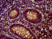 IHC image of CSB-PA753588LA01HU diluted at 1:400 and staining in paraffin-embedded human appendix tissue performed on a Leica BondTM system. After dewaxing and hydration, antigen retrieval was mediated by high pressure in a citrate buffer (pH 6.0)...