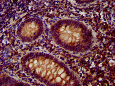 IHC image of CSB-PA753588LA01HU diluted at 1:400 and staining in paraffin-embedded human appendix tissue performed on a Leica BondTM system. After dewaxing and hydration, antigen retrieval was mediated by high pressure in a citrate buffer (pH 6.0)...