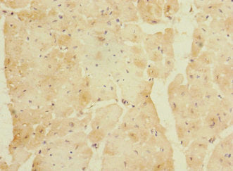 Immunohistochemistry of paraffin-embedded human heart tissue using CSB-PA753708LA01HU at dilution of 1:100