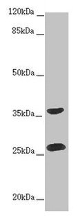 Western blot All lanes: RAB12 antibody at 2ug/ml + Hela whole cell lysate Secondary Goat polyclonal to rabbit IgG at 1/10000 dilution Predicted band size: 28 kDa Observed band size: 28, 36 kDa