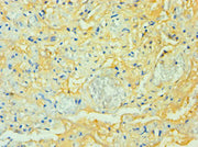 Immunohistochemistry of paraffin-embedded human lung tissue using CSB-PA753711DSR1HU at dilution of 1:100