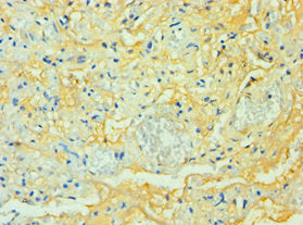 Immunohistochemistry of paraffin-embedded human lung tissue using CSB-PA753711DSR1HU at dilution of 1:100