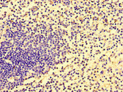 Immunohistochemistry of paraffin-embedded human spleen tissue using CSB-PA754020LA01HU at dilution of 1:100