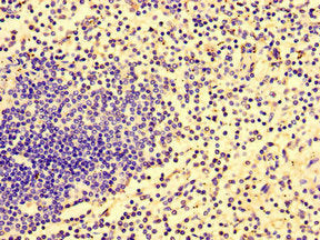 Immunohistochemistry of paraffin-embedded human spleen tissue using CSB-PA754020LA01HU at dilution of 1:100