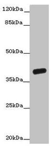 Western blot All lanes: OGFOD2 antibody at 3µg/ml + Mouse liver tissue Secondary Goat polyclonal to rabbit IgG at 1/10000 dilution Predicted band size: 39, 33, 15, 21 kDa Observed band size: 39 kDa